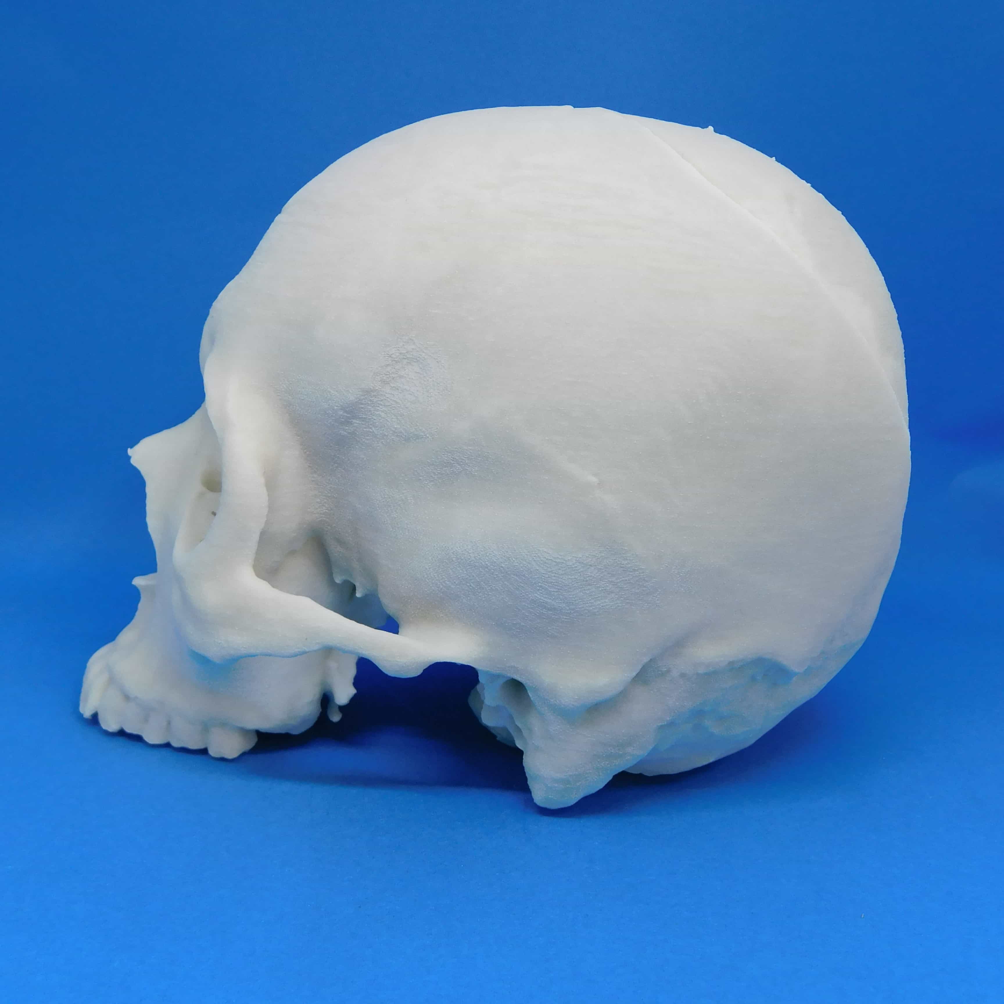 頭蓋骨 下顎なし A11-Bの医療模型 | 3DモデルのKEZLEX