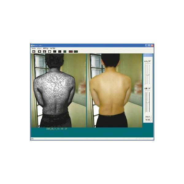 モアレ式体型観察装置 モアレルック 基本セット・PC付 ＊メーカー保証